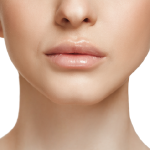 Tratamientos faciales, Dra. Juanita Camacho medicina estética, medicina estética , Bogota , tratamientos estéticos faciales, tratamientos estéticos