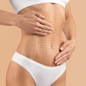 Tratamientos esteticos, tratamientos corporales, col esthetics, obesidad, tratamientos obesidad