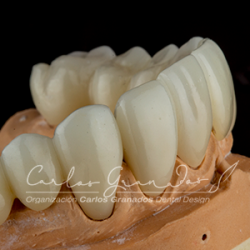 Dr. Carlos Granados, bogotá, tratamientos dentales, odontologia, tratamientos orales, salud oral, dientes, blanqueamientos, valoración dental, servicio de valoracion, col esthetics, carillas, estetica dental, blanqueamiento, rehabilitacion oral, incrustacioones, coronas dentales