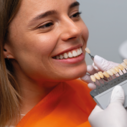 Carilla por diente, carillas dentales, tratamientos esteticos, tratamientos dentales, col esthetics