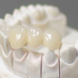 Toxina butolinica, tartamientos faciales, tratamientos dentales, tratamiento bruxismo, medellin, tratamientos esteticos, estetica dental, estetica facial, col esthetics, mantenimiento diseño de sonrisa, diseño de sonrissa, diseño dental, sonrisa perfecta, limpieza dental, profilaxis, skin booster, armonizacion facial, armonizacion orofacial, orofacial, NCTF facial, NCTF, sculptra, sculptra facial, radiesse, acido hialuronico, toxina butolinica, blanqueamiento, odontologia, odontologia estetica, disñeo de sonrisa, cermoreo, resina, diseño de sonrisa en ceromero, diseño de sonrisa en ceramica, diseño de sonrisa resina, coronas, incrustaciones dentales, coronas dentales.