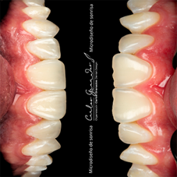 Dr. Carlos Granados, bogotá, tratamientos dentales, odontologia, tratamientos orales, salud oral, dientes, blanqueamientos, valoración dental, servicio de valoracion, col esthetics, carillas, estetica dental, blanqueamiento, rehabilitacion oral, incrustacioones, coronas dentales