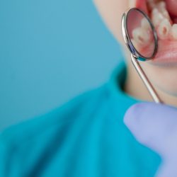 Close up of dentist's hands with assistant in blue gloves are treating teeth to a child, patient's face is closed.